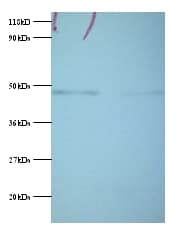 IHC-plus™ PGK1 / Phosphoglycerate Kinase Antibody