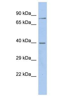 Polyclonal Rabbit anti-Human GABRA2 Antibody (aa214-263, WB)