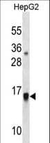 GMF Beta / GMFB Antibody (aa49-78)