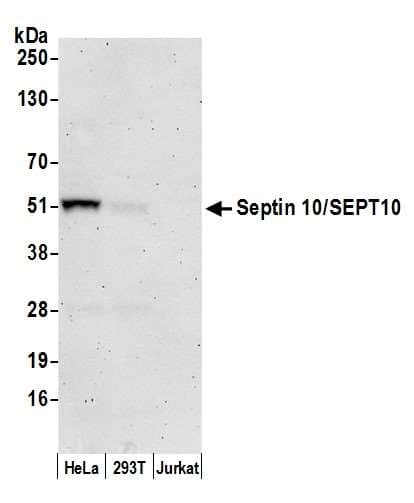 SEPT10 /Septin 10 Antibody (aa404-454)