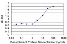 ABCB2 / TAP1 Antibody (clone 3D10)