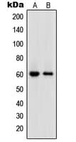Polyclonal Rabbit anti-Human POLE2 Antibody (Internal, WB)