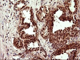 UPRT Antibody (clone OTI2F2)
