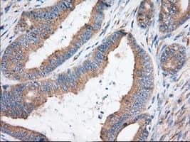 Monoclonal Mouse anti-Human KHK / Ketohexokinase Antibody (clone OTI3C4, IHC, WB)