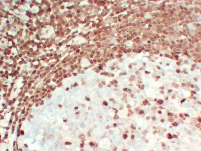 CDKN1B / p27 Kip1 Antibody (clone ABT-p27)