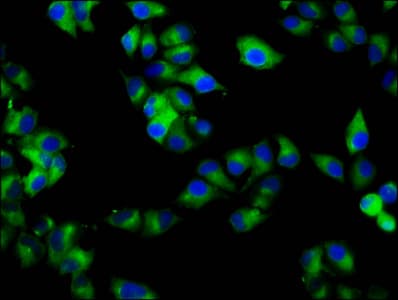 Polyclonal Rabbit anti-Human RAB7B Antibody (IF)