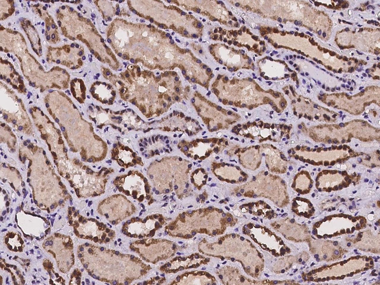 CMC1 Antibody