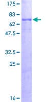 Human PSPLA1 / Phospholipase A1 Protein (Recombinant GST)