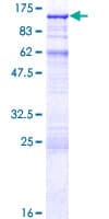 Human ACAP2 / Centaurin Beta 2 Protein (Recombinant GST)