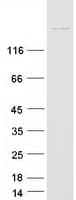 Human NBAS / NAG Protein (Recombinant Myc-DDK (Flag))