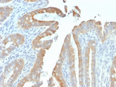 KRT19 / CK19 / Cytokeratin 19 Antibody (clone rKRT19/799, Azide-free, Carrier-free)