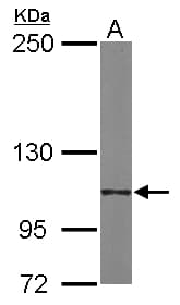 ITGA6/Integrin Alpha 6/CD49f Antibody (aa565-872)