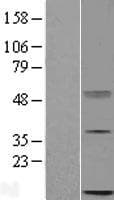 C16orf13 Protein (Over-Expression Lysate Myc-DDK (Flag))
