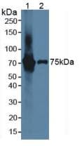 IL17RE Antibody (aa457-626)