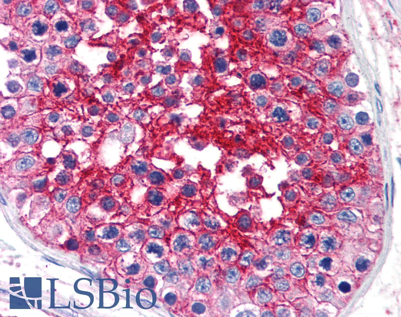 IHC-plus™ Monoclonal Mouse anti-Human Basigin / Emmprin / CD147 Antibody (clone MEM-M6/1, IHC, WB)
