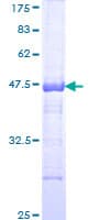 Human PIKFYVE / PIP5K Protein (Recombinant GST)