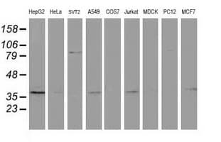 RTN4IP1 / NIMP Antibody (clone OTI1B2)