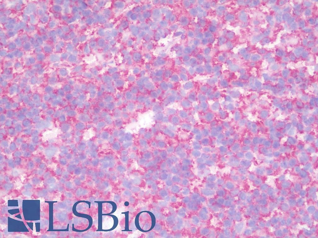 IHC-plus™ Monoclonal Mouse anti-Human HLA-A/B/C Antibody (clone W6/32, IHC)