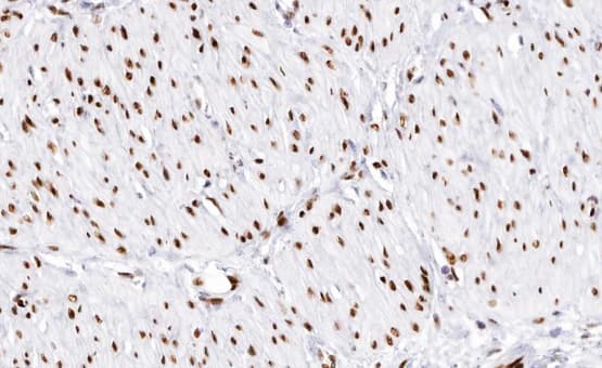 DLX3 Antibody (aa87-137)