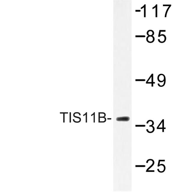 ZFP36L1 Antibody (Asp88)