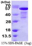 Human p66 / SHC Protein (Recombinant His)