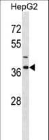IGBP1 Antibody (aa142-171)