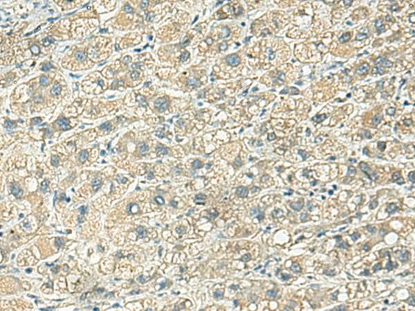 KLC2 Antibody