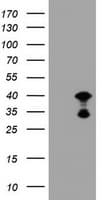PRR11 Antibody (aa125-360, clone OTI3C8)