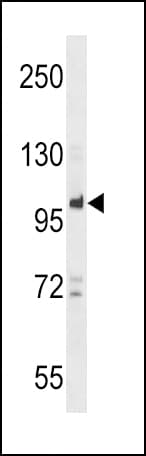 PTPN22 / PEP Antibody (aa663-691)