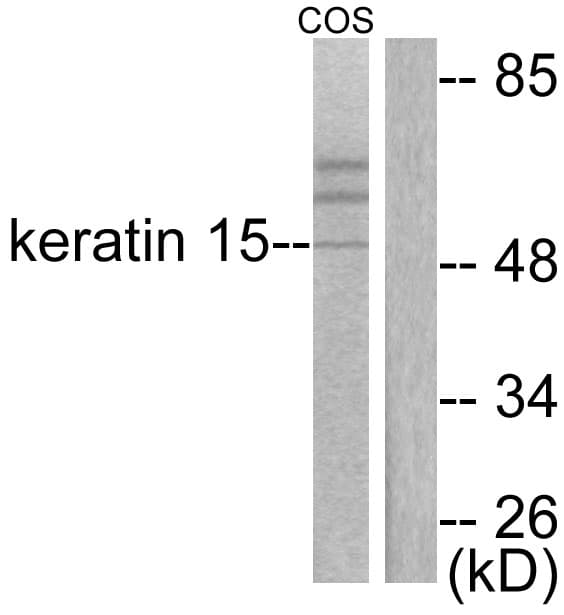 PathPlus™ KRT15 / CK15 / Cytokeratin 15 Antibody (aa1-50)