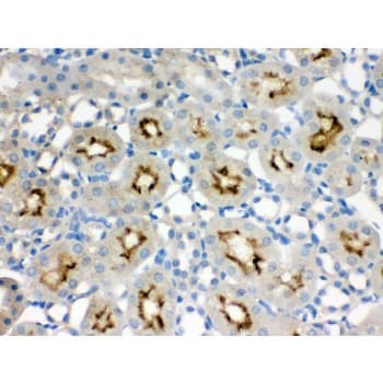 SMC3 / HCAP Antibody (aa1178-1216)