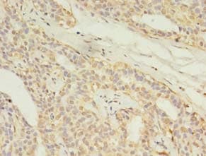 Polyclonal Rabbit anti-Human MAS1L / MRG Antibody (IHC, WB)