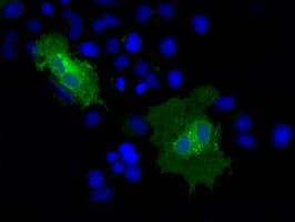 CD36 Antibody (clone OTI3F4)