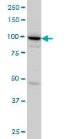 Monoclonal Mouse anti-Human SH3D19 Antibody (clone 5C7, IF, WB)