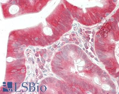 PathPlus™ Monoclonal Mouse anti-Human CASP3 / Caspase 3 Antibody (clone ABM1C12, IHC, WB)