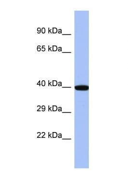ZNF707 Antibody (C-Terminus)