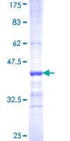 Human SLC1A2 / EAAT2 / GLT-1 Protein (Recombinant GST, N-terminus)
