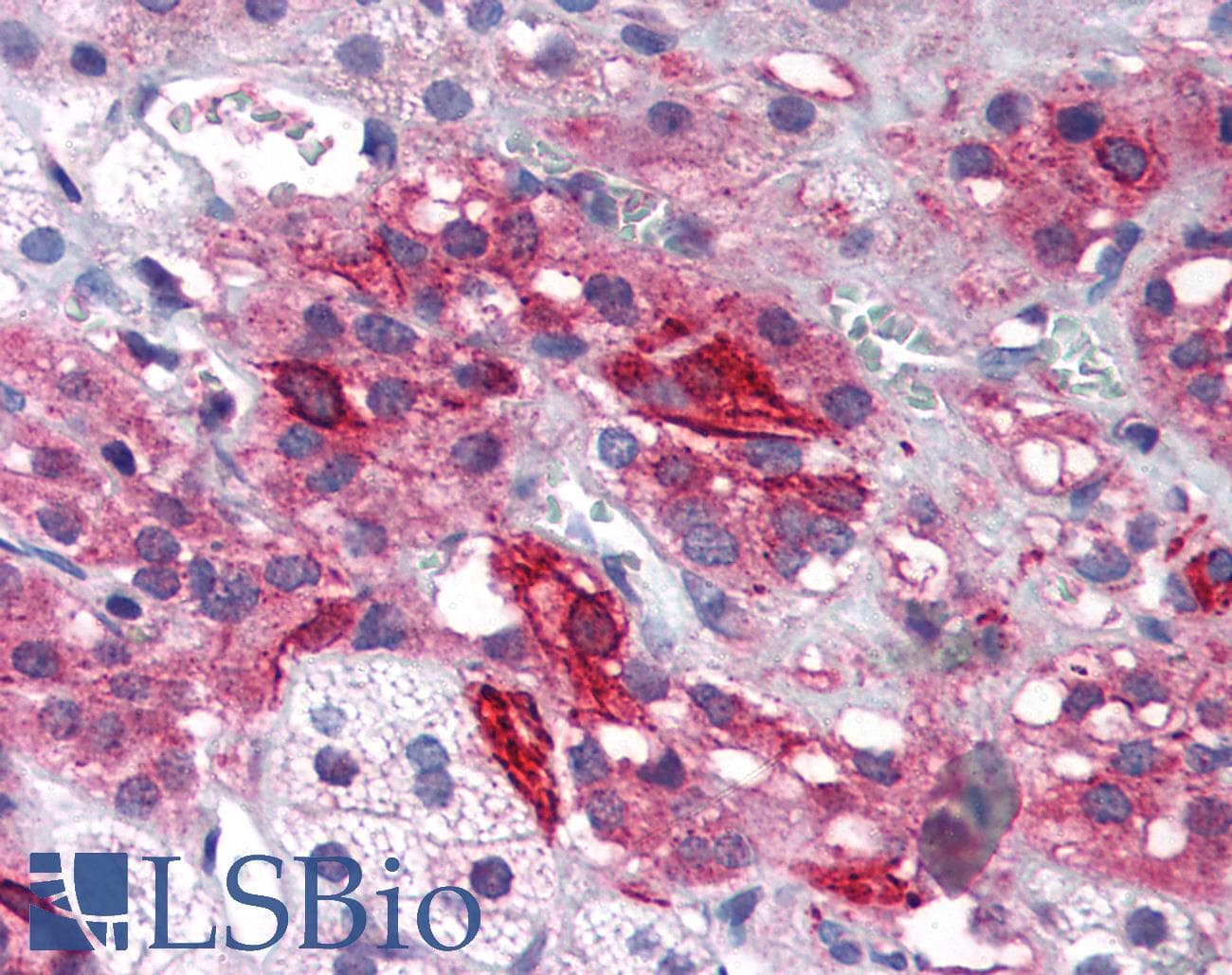 IHC-plus™ Polyclonal Rabbit anti-Human GRIK1 / GLUR5 Antibody (IHC, IF, WB)