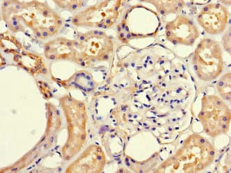 FRMD5 Antibody