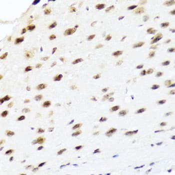 Polyclonal Rabbit anti-Human PTEN Antibody (IHC, WB)