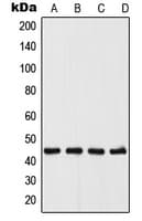 Polyclonal Rabbit anti-Human UGCG Antibody (N-Terminus, WB)