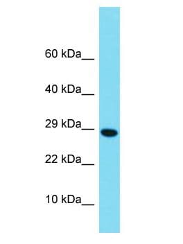 Polyclonal Rabbit anti-Human H2BFM Antibody (aa100-148, WB)
