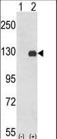 Polyclonal Rabbit anti-Human FAK / Focal Adhesion Kinase Antibody (aa821-848, IHC, IF, WB)