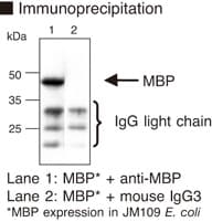 MBP / Maltose Binding Protein Antibody (clone 1G12)