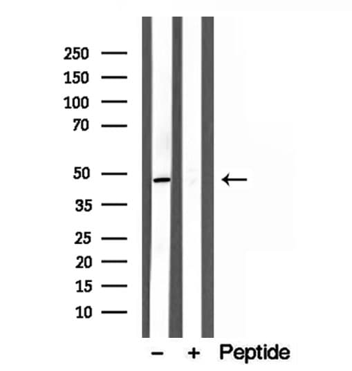 Polyclonal Rabbit anti-Human FLOT1 / Flotillin 1 Antibody (IHC, WB)