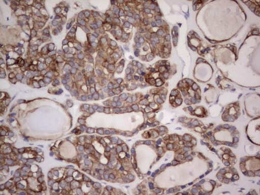 Monoclonal Rat anti-Human Acidic Cytokeratin Antibody (clone 2G10, IHC)