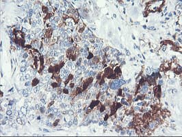 SERPINB2 / PAI-2 Antibody (clone 1F6, Carrier-free)