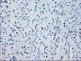 SORD / Sorbitol Dehydrogenase Antibody (clone OTI2A10)