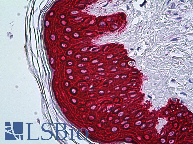PathPlus™ KRT5 / CK5 / Cytokeratin 5 Antibody (aa541-590)