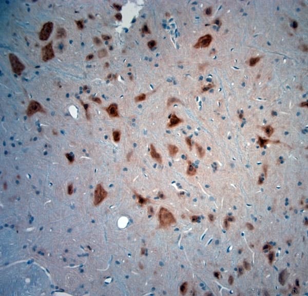 Polyclonal Rabbit anti-Human NeuN Antibody (aa80-130, IHC, WB)